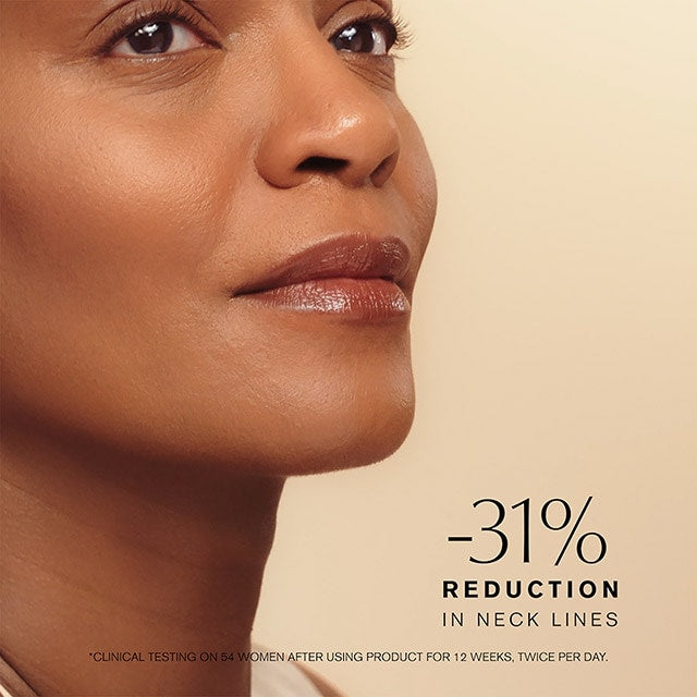 Before and after images showing the results of using Estée Lauder Revitalizing Supreme+ Youth Power Creme SPF 25 Moisturizer. The cream visibly improves skin firmness and texture, reducing fine lines and providing a hydrated, youthful glow.