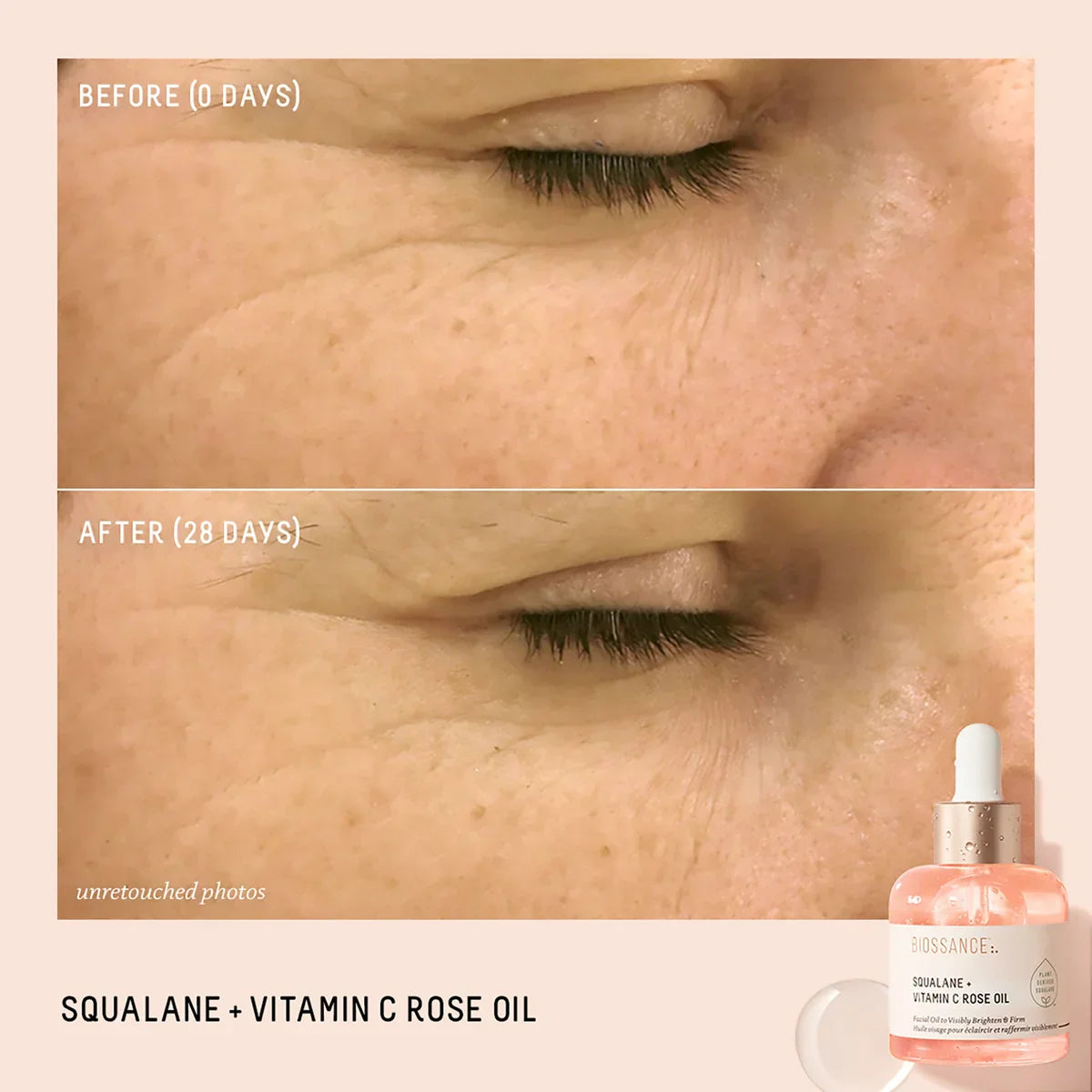 Biossance Squalane + Vitamin C Rose Oil Before and After Results